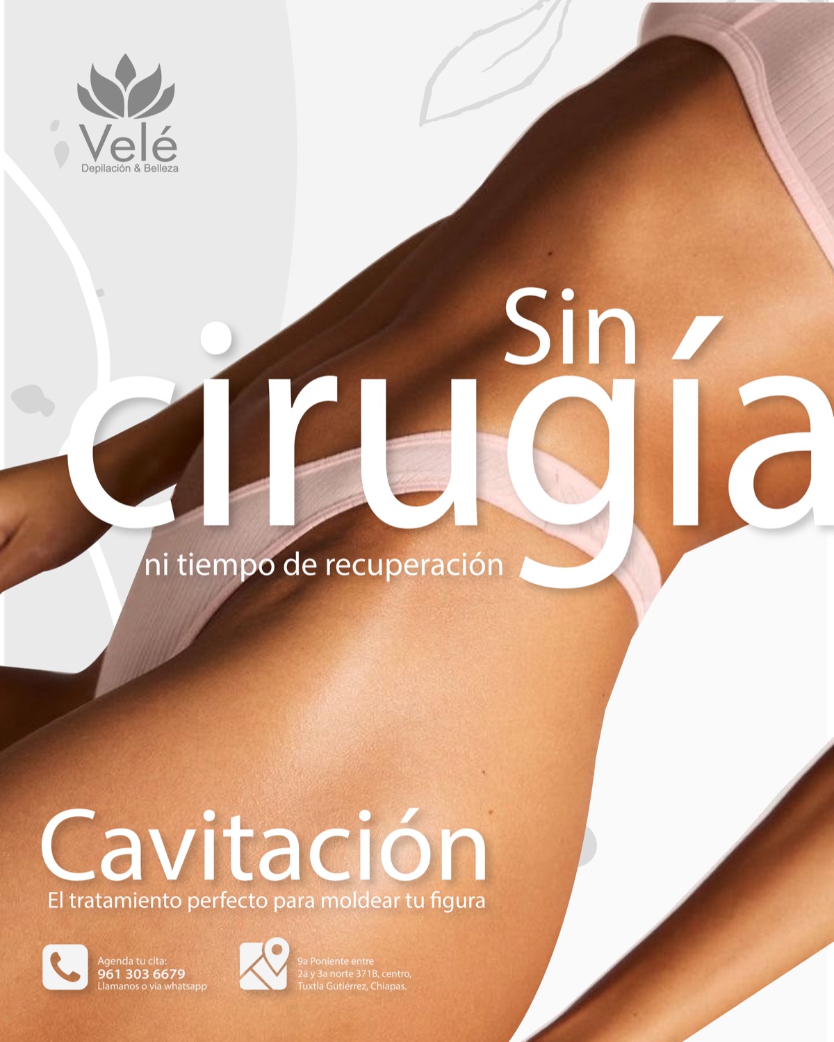 Cavitación y radiofrecuencia corporal — Moldeo de zonas en spa Tuxtla