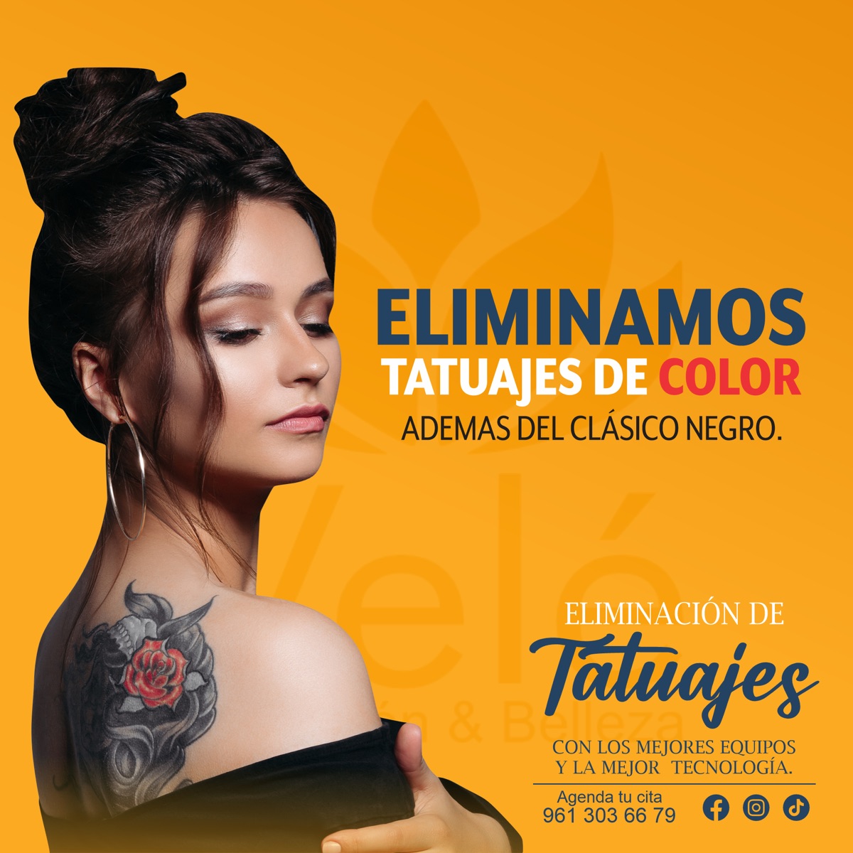 Eliminación de tatuajes con picoláser en Tuxtla Gutiérrez — VELÉ spa